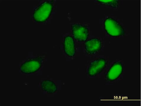 Anti-KIF22 antibody produced in mouse purified immunoglobulin, buffered aqueous solution