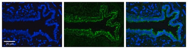 Anti-SerPINE1 (AB1) antibody produced in rabbit affinity isolated antibody