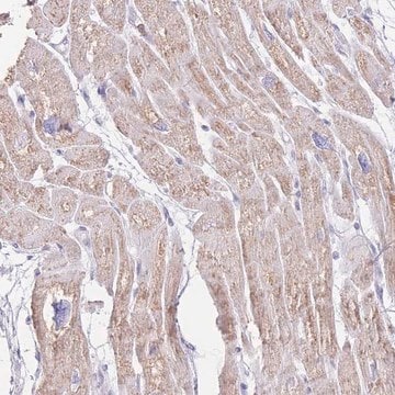 Anti-LCLAT1 antibody produced in rabbit Prestige Antibodies&#174; Powered by Atlas Antibodies, affinity isolated antibody, buffered aqueous glycerol solution