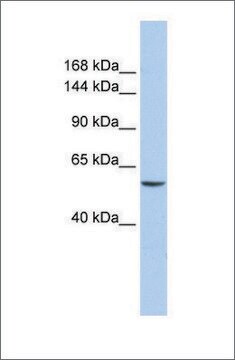 抗CHD2抗体 ウサギ宿主抗体 affinity isolated antibody