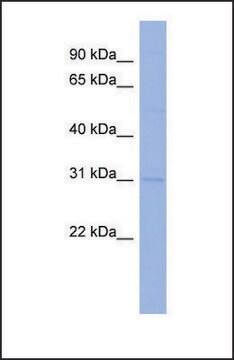 Anti-CLDN18 antibody produced in rabbit affinity isolated antibody