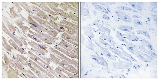 Anti-MRPL16 antibody produced in rabbit affinity isolated antibody