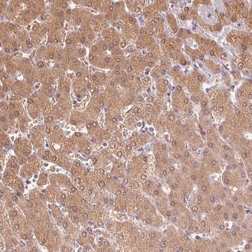 Anti-DGUOK antibody produced in rabbit Prestige Antibodies&#174; Powered by Atlas Antibodies, affinity isolated antibody, buffered aqueous glycerol solution