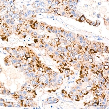 Anti-MMP7 Antibody, clone 9D8S10, Rabbit Monoclonal