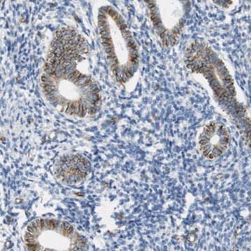 Anti-MS4A10 antibody produced in rabbit Prestige Antibodies&#174; Powered by Atlas Antibodies, affinity isolated antibody, buffered aqueous glycerol solution