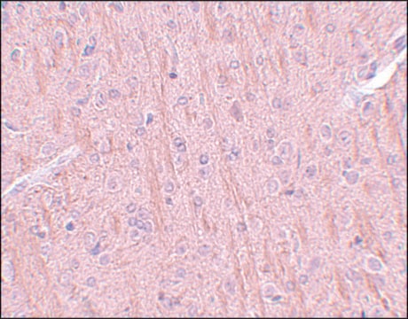 Anti-CCDC106 antibody produced in rabbit affinity isolated antibody, buffered aqueous solution