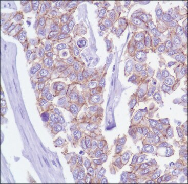 Anti-P120 (Catenin delta 1) antibody, Rabbit monoclonal recombinant, expressed in proprietary host, clone SP63, affinity isolated antibody