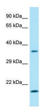 Anti-SGTA (C-terminal) antibody produced in rabbit affinity isolated antibody