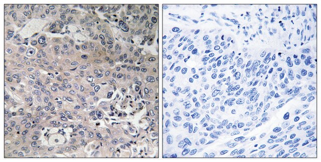 Anti-TUFM antibody produced in rabbit affinity isolated antibody