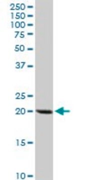 Anti-DHFR antibody produced in rabbit purified immunoglobulin, buffered aqueous solution