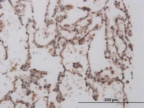 ANTI-FOXL1 antibody produced in mouse clone 2C2, purified immunoglobulin, buffered aqueous solution