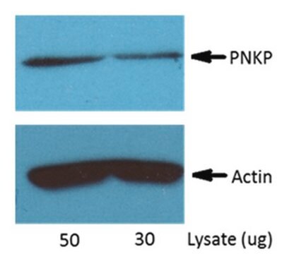 Anti-PNKP Antibody, clone H101.2 clone H101.2, from mouse