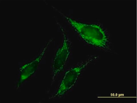 Anti-PNPT1 antibody produced in mouse purified immunoglobulin, buffered aqueous solution