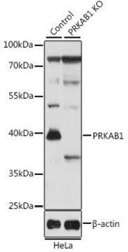 Anti-PRKAB1 antibody produced in rabbit