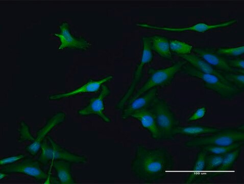 Anti-PSME1 antibody produced in rabbit purified immunoglobulin, buffered aqueous solution