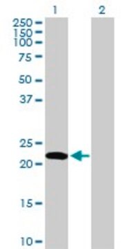 Anti-EDN1 antibody produced in rabbit purified immunoglobulin, buffered aqueous solution