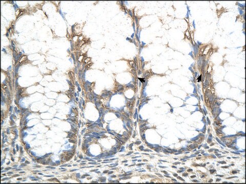 Anti-CHIC2 antibody produced in rabbit affinity isolated antibody