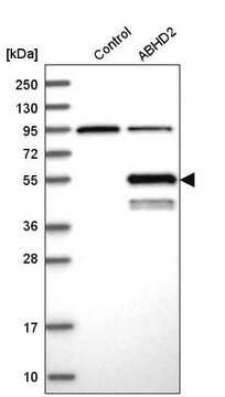 Anti-ABHD2 antibody produced in rabbit Prestige Antibodies&#174; Powered by Atlas Antibodies, affinity isolated antibody, buffered aqueous glycerol solution