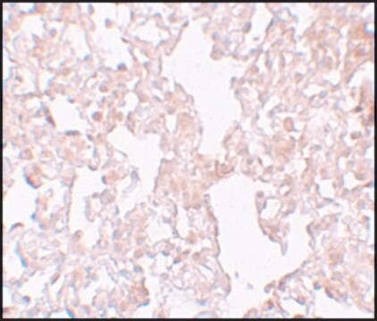 Anti-MFSD1 antibody produced in rabbit affinity isolated antibody, buffered aqueous solution