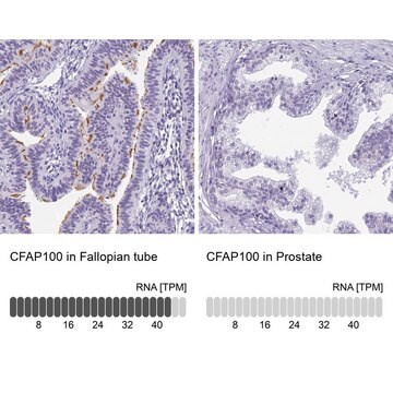 Anti-CFAP100 antibody produced in rabbit Prestige Antibodies&#174; Powered by Atlas Antibodies, affinity isolated antibody, buffered aqueous glycerol solution