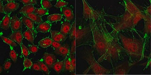 Anti-Actin from rabbit, purified by affinity chromatography