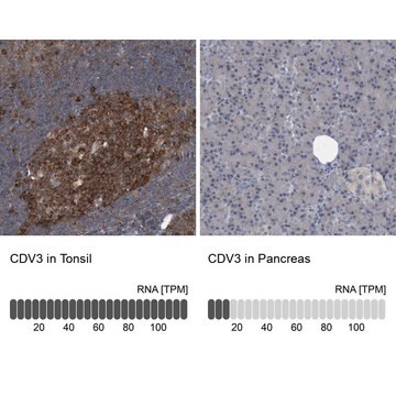 Anti-CDV3 antibody produced in rabbit Prestige Antibodies&#174; Powered by Atlas Antibodies, affinity isolated antibody, buffered aqueous glycerol solution, ab2