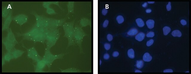 Anti-eIF4ENIF1 (N-terminal) antibody produced in rabbit affinity isolated antibody, buffered aqueous solution