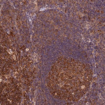 Anti-TRMT1 antibody produced in rabbit Prestige Antibodies&#174; Powered by Atlas Antibodies, affinity isolated antibody, buffered aqueous glycerol solution