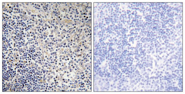 Anti-TPIP1, antibody produced in rabbit affinity isolated antibody