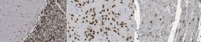 Anti-Fox1 Antibody, clone A2BP1 clone A2BP1, from rat