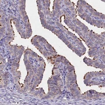 Anti-CCDC189 antibody produced in rabbit Prestige Antibodies&#174; Powered by Atlas Antibodies, affinity isolated antibody, buffered aqueous glycerol solution