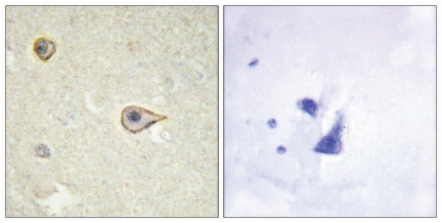 Anti-Cytochrome P450 19A1 antibody produced in rabbit affinity isolated antibody