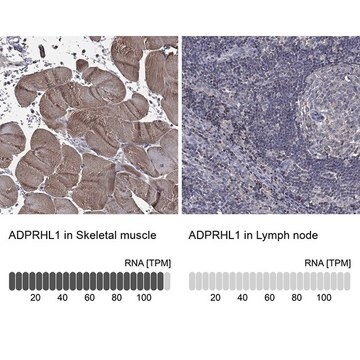 Anti-ADPRHL1 antibody produced in rabbit Prestige Antibodies&#174; Powered by Atlas Antibodies, affinity isolated antibody, buffered aqueous glycerol solution