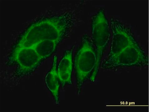 Anti-HK1 antibody produced in mouse purified immunoglobulin, buffered aqueous solution