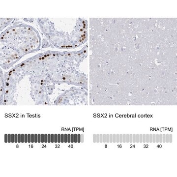 Anti-SSX2 antibody produced in rabbit Prestige Antibodies&#174; Powered by Atlas Antibodies, affinity isolated antibody, buffered aqueous glycerol solution