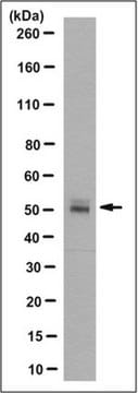 Anti-E3 ubiquitin-protein ligase CBL-C Antibody, clone 10F4.2 clone 10F4.2, from mouse