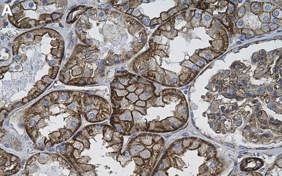 Anti-Spectrin &#945; Antibody, clone 1D4 ZooMAb&#174; Rabbit Monoclonal recombinant, expressed in HEK 293 cells