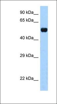 Anti-TAPBPL antibody produced in rabbit affinity isolated antibody