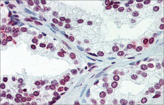 Anti-ARID5A (ab2) antibody produced in rabbit affinity isolated antibody