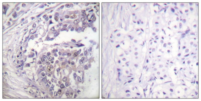 Anti-Histone H2B (Acetyl-Lys5) antibody produced in rabbit affinity isolated antibody