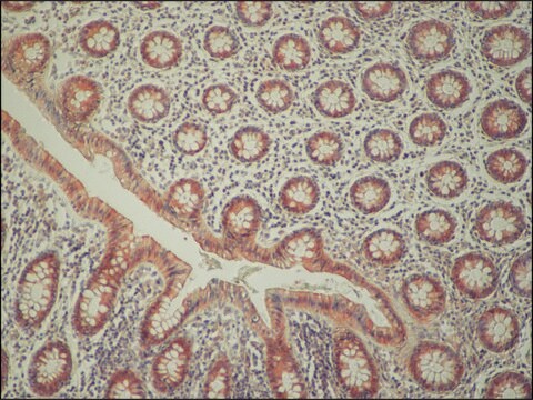 Anti-C9orf72 antibody produced in rabbit affinity isolated antibody