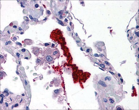 Anti-KLK6 antibody produced in rabbit affinity isolated antibody