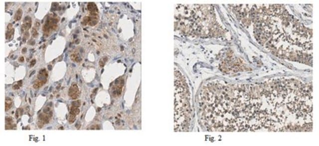 Anti-PNMT Antibody from rabbit, purified by affinity chromatography