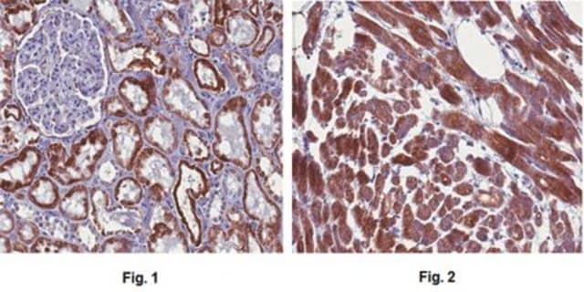 Anti-APC Antibody, CT, clone C-APC Antibody 28.9, Ascites Free clone C-APC 28.9, from mouse