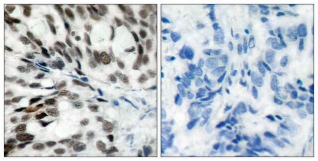 Anti-Retinoblastoma antibody produced in rabbit affinity isolated antibody