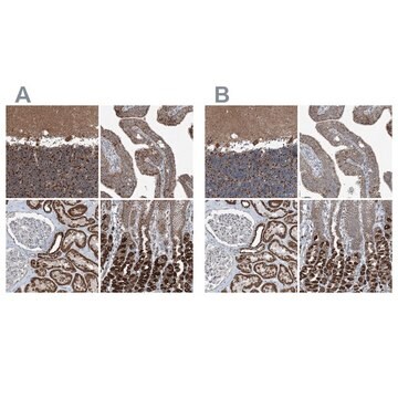 Anti-SUCLG1 antibody produced in rabbit Prestige Antibodies&#174; Powered by Atlas Antibodies, affinity isolated antibody, buffered aqueous glycerol solution