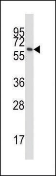 ANTI-BTN3A1 (C-TERM) antibody produced in rabbit IgG fraction of antiserum, buffered aqueous solution