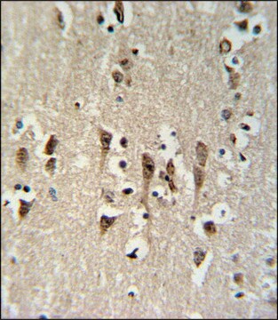 ANTI-KCTD1 (C-TERM) antibody produced in rabbit IgG fraction of antiserum, buffered aqueous solution