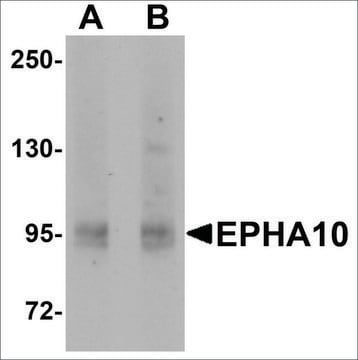 Anti-EPHA10 antibody produced in rabbit affinity isolated antibody, buffered aqueous solution