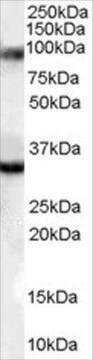 Anti-ZASP/CYPHER/LDB3 affinity isolated antibody, buffered aqueous solution